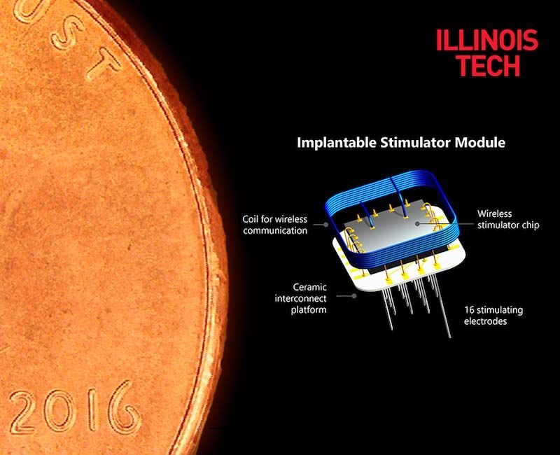 Intracortical Visual Prosthesis \