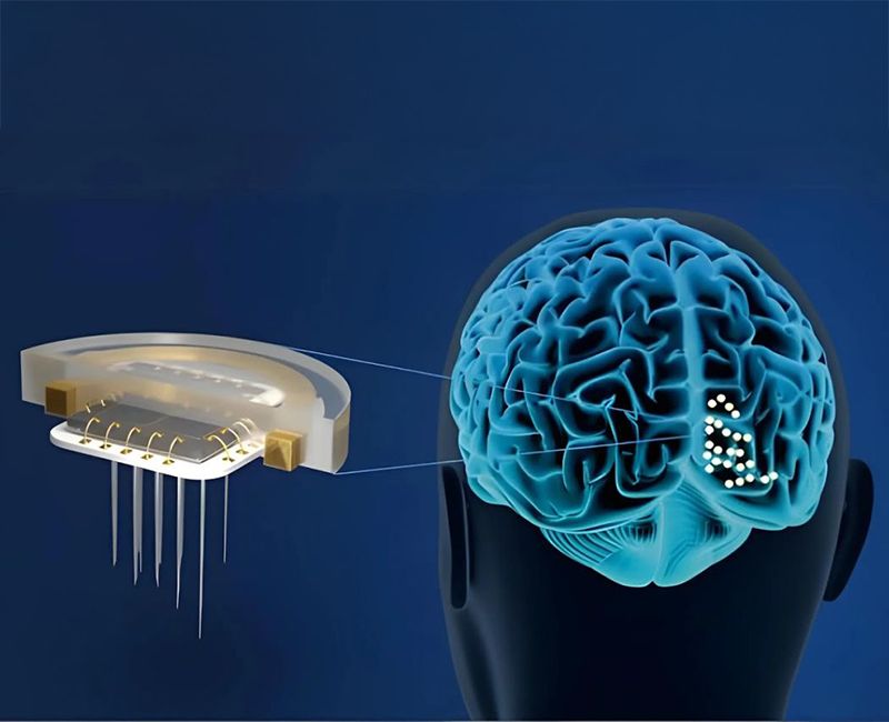 Graphic of how Illinois Tech-led ICVD implant works